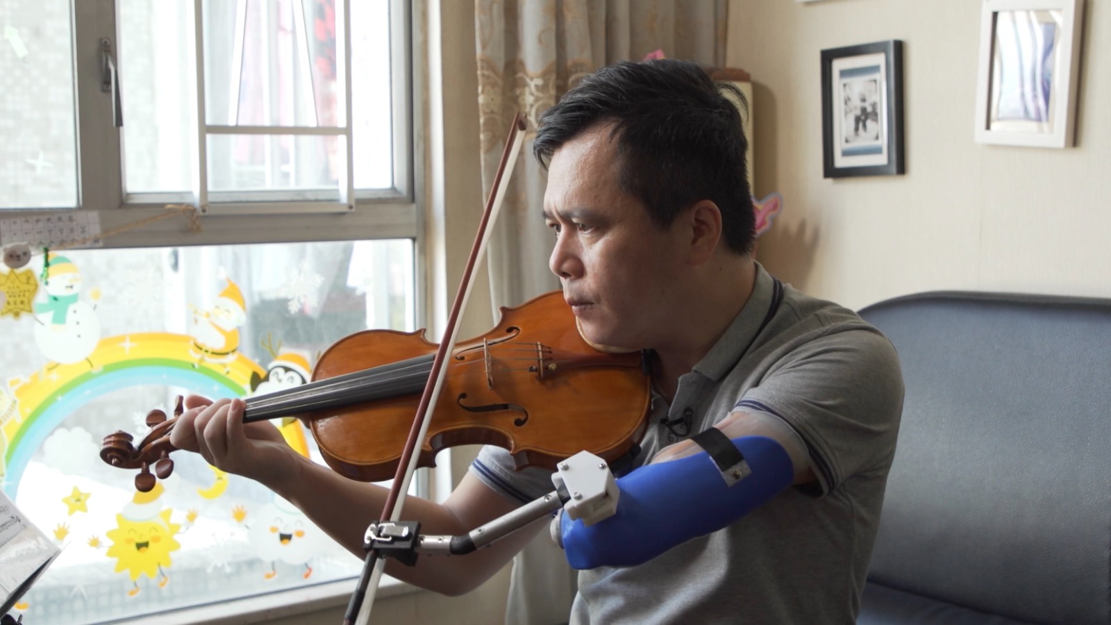 阿富早年因交通意外而手部截肢，需要裝上特製義肢拉奏小提琴。