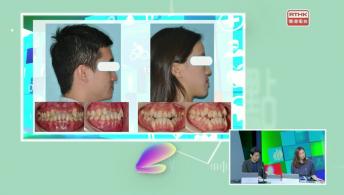 香港牙医学会系列 - 不同牙齿问题及矫齿方法